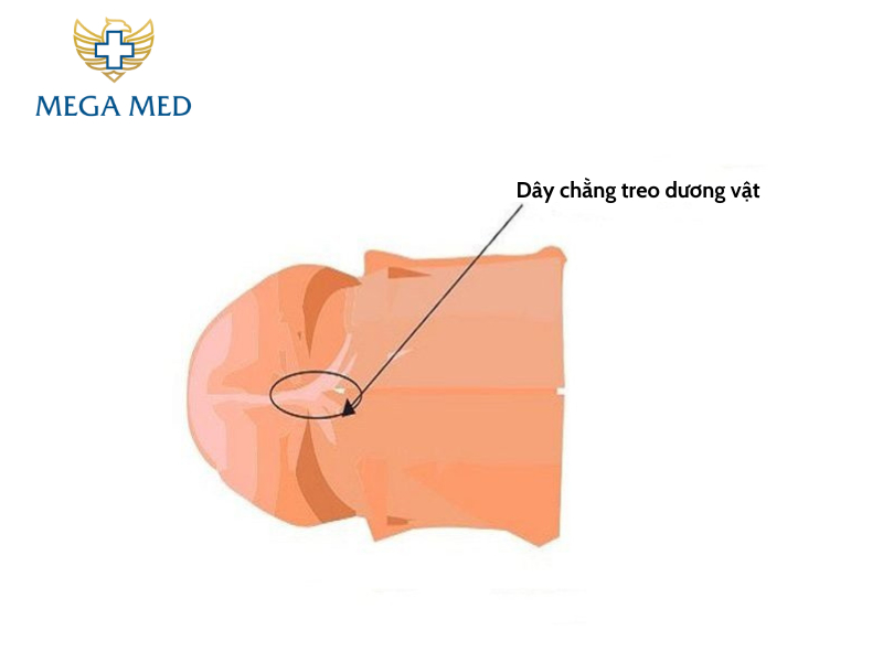 phẫu thuật làm to dương vật